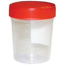 URINE CONTAINER STERILE